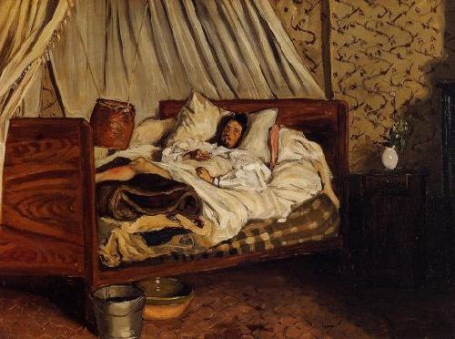 Frederic Bazille Monet after His Accident at the Inn of Chailly Sweden oil painting art